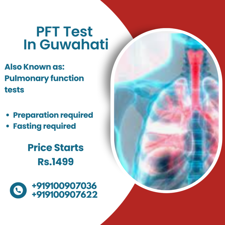 PFt test in Guwahati