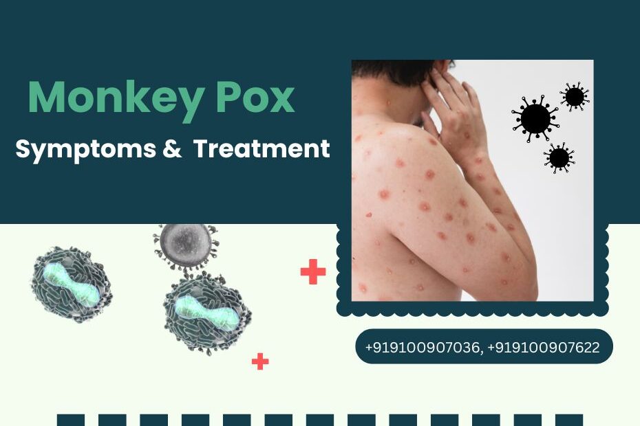 Monkeypox Disease