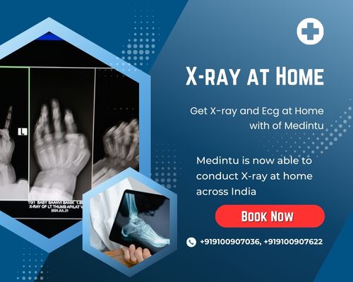 xray at home