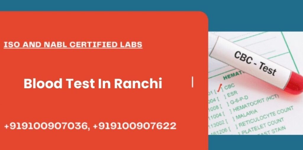 Blood Test In Ranchi