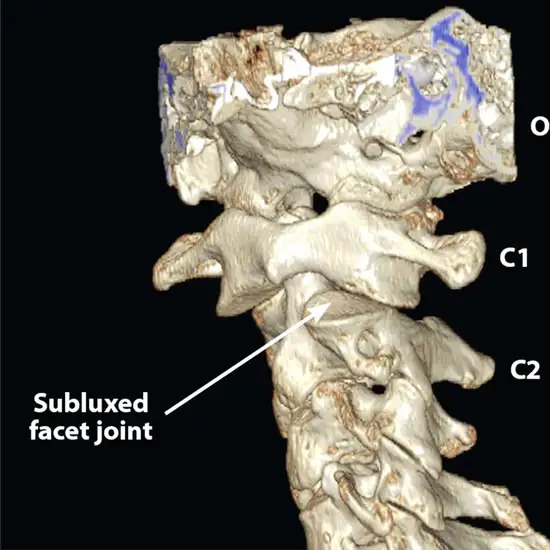 CT-CV-Junction-3D-Reconstruction
