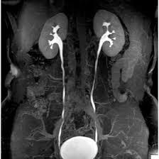 MRI-KUB