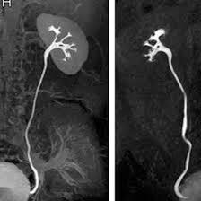 MRI-Kub-Region