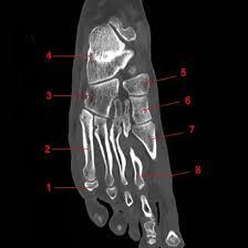 NCCT Left Foot