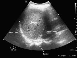 USG Whole Abdomen