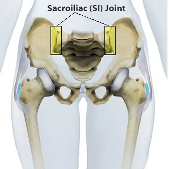 MRI Scan Sacroiliac Joint | Medintu