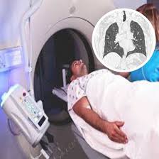 CECT Chest And Lower Neck