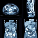 CECT Whole Abdomen Scan