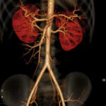 CT Abdomen Angiography