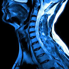 MRI Screening Of CX-Dorsal Spine