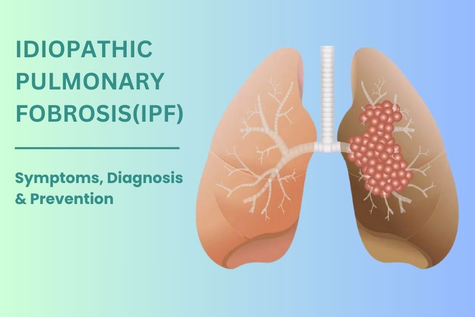 Idiopathic pulmonary fibrosis