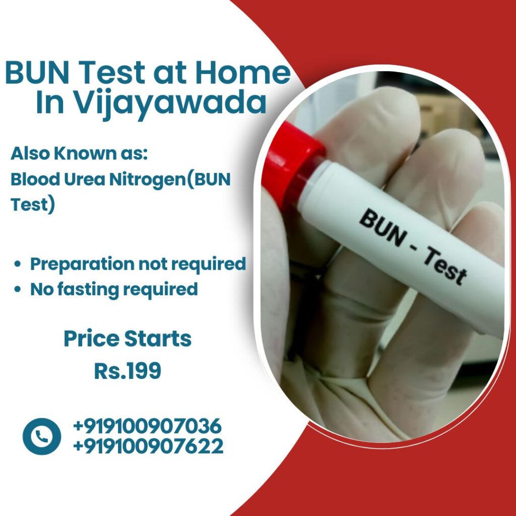 BUN Test in vijayawada