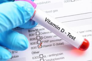 Vitamin D Test