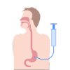 Ryles Tube Insertion at home