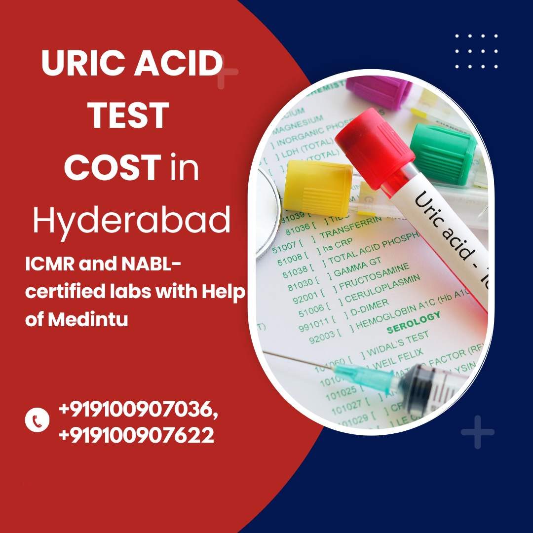 Uric acid test