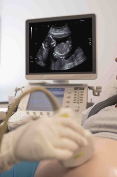 Ultrasound Scan Test for Pregnancy